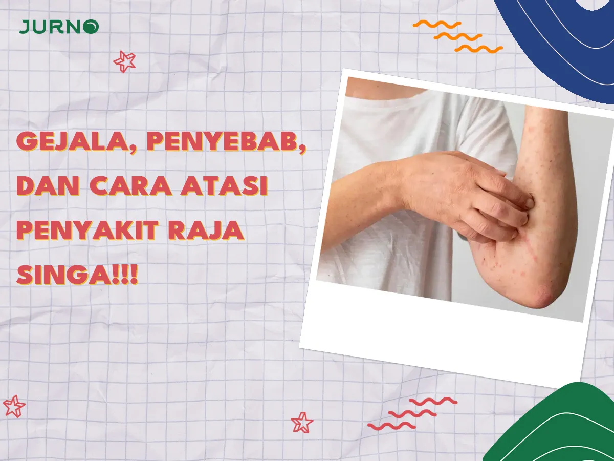 Gejala, Penyebab, dan Cara Mengatasi Penyakit Raja Singa Gejala, Penyebab, dan Cara Mengatasi Penyakit Raja Singa