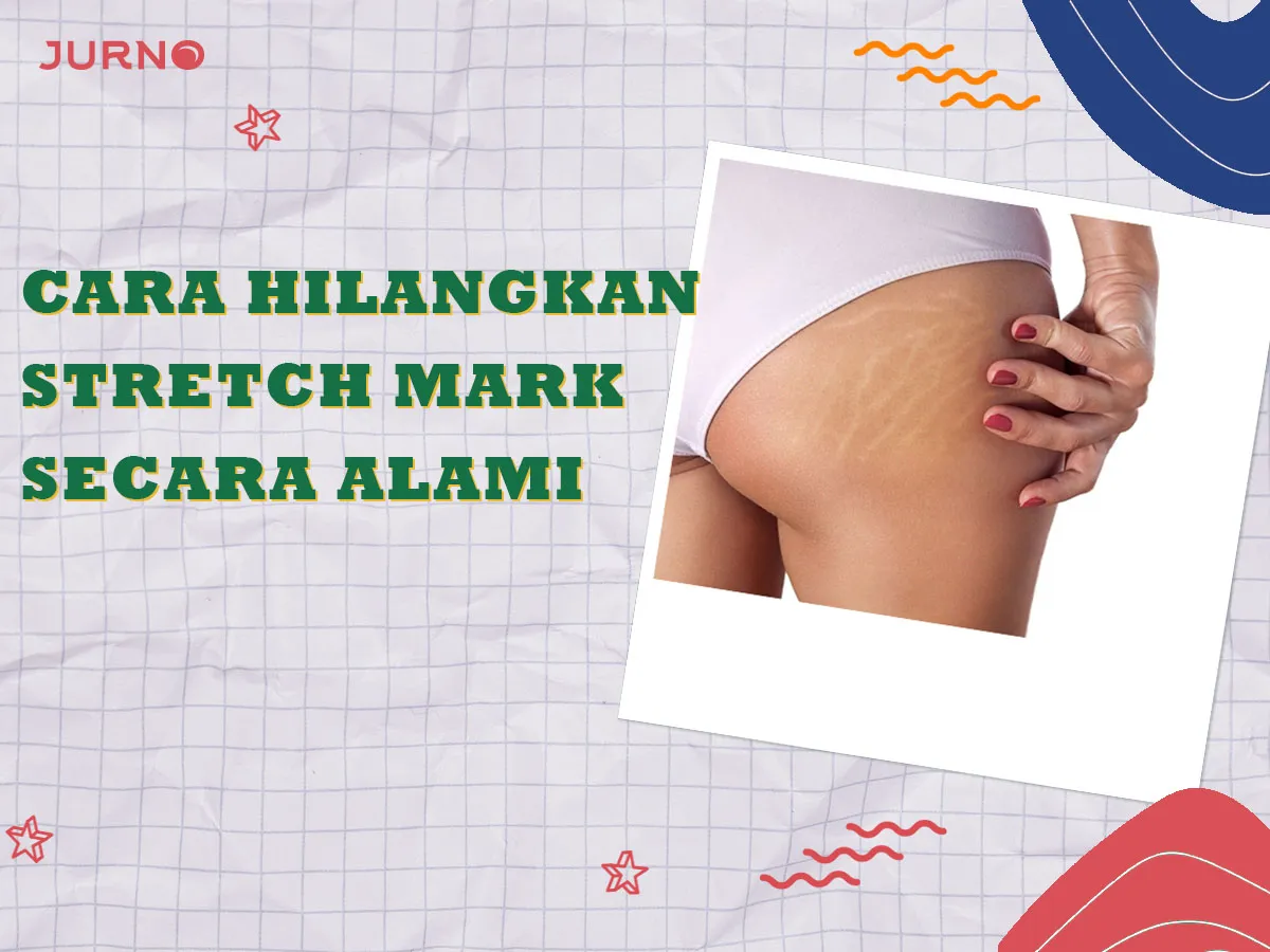 Ini Dia Cara Menghilangkan Stretch Mark Secara Alami yang Terbukti Ampuh Ini Dia Cara Menghilangkan Stretch Mark Secara Alami yang Terbukti Ampuh
